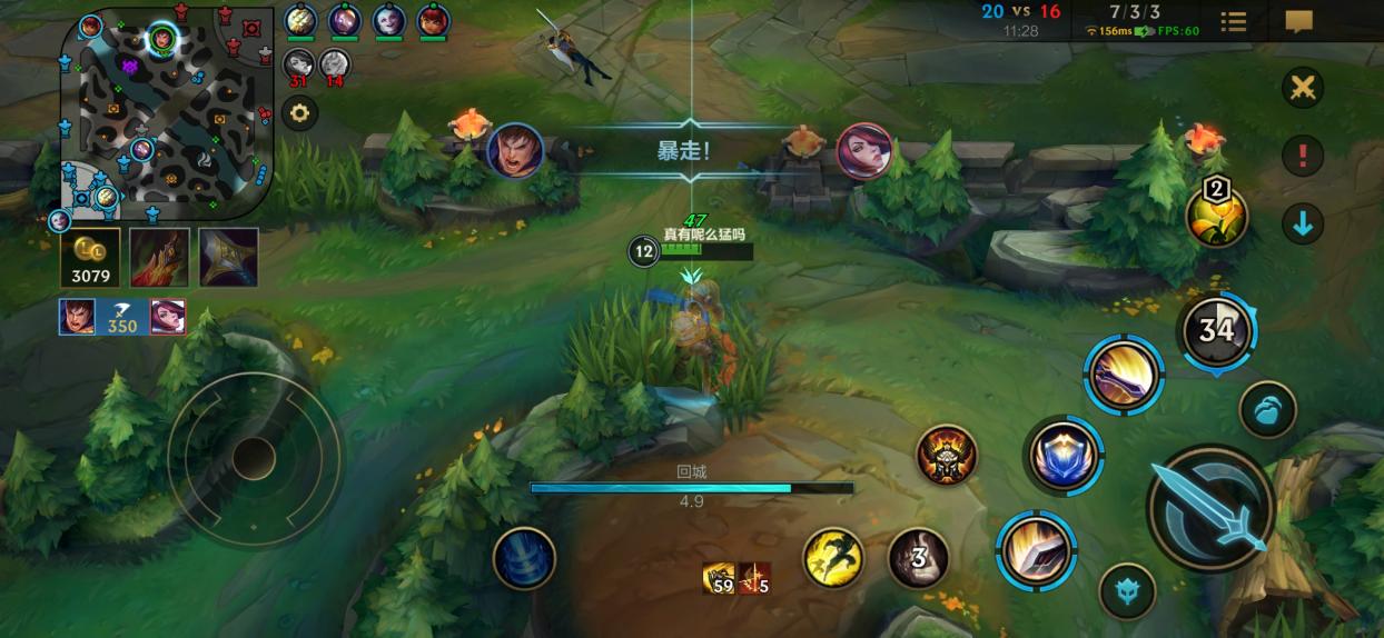 英雄联盟手游盖伦有哪些需要学会的技巧